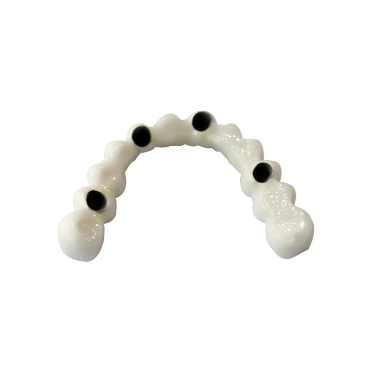 4 On 4 Dental Implants