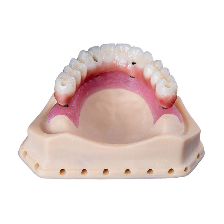 4 On 4 Dental Implants