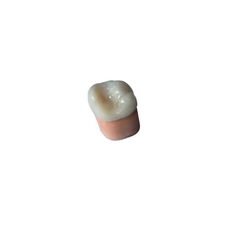 A2 Zirconia Crown