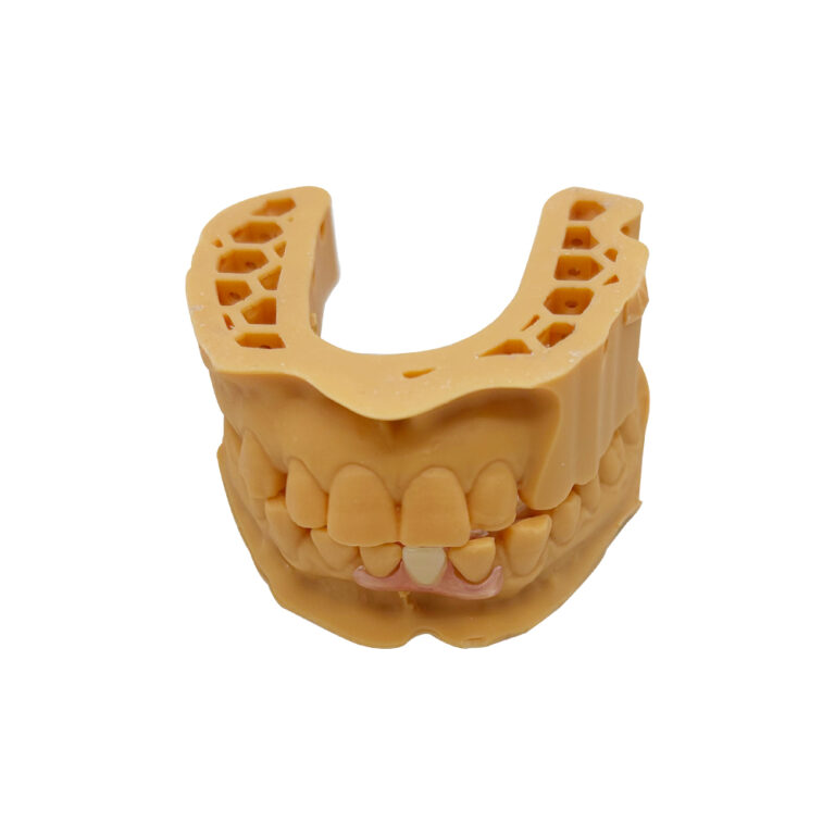 Adding Teeth to Valplast Partials Denture