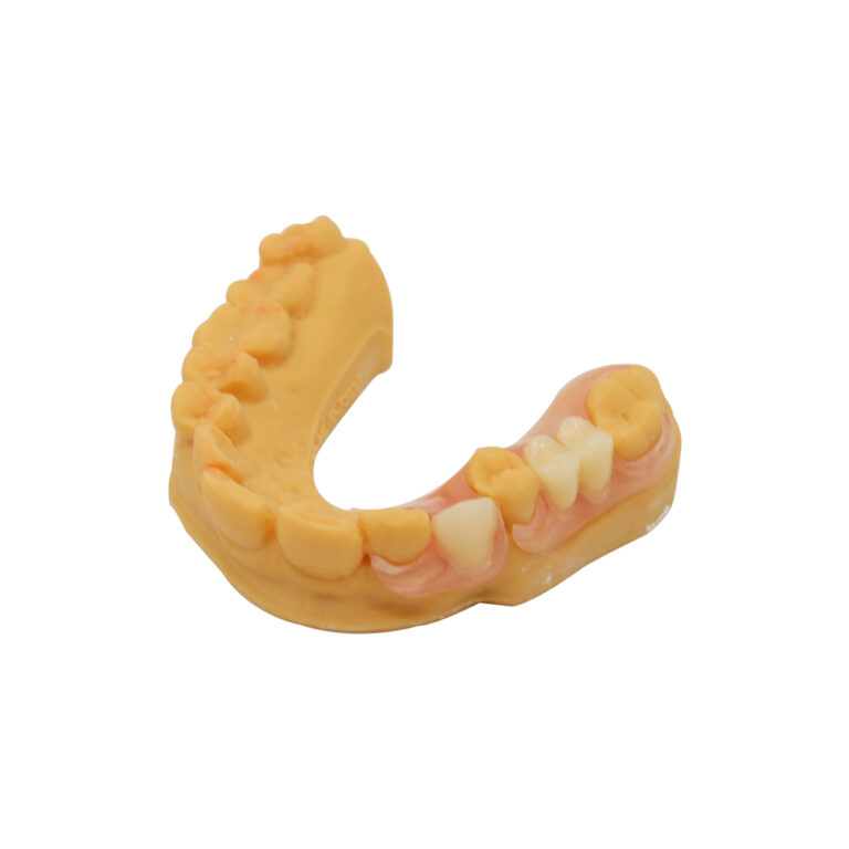 Affordable Broken Partial Denture Repair