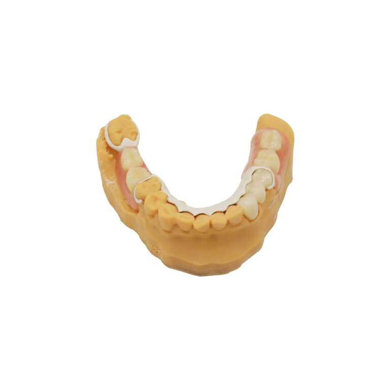 Affordable Broken Partial Denture Repair