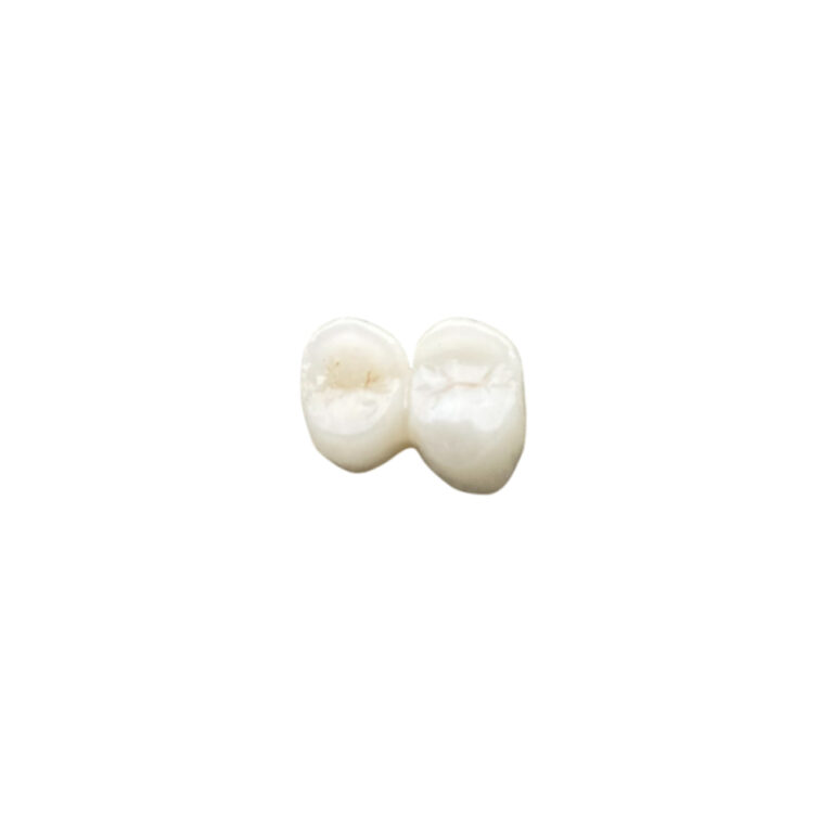 B1 Zirconia Crowns