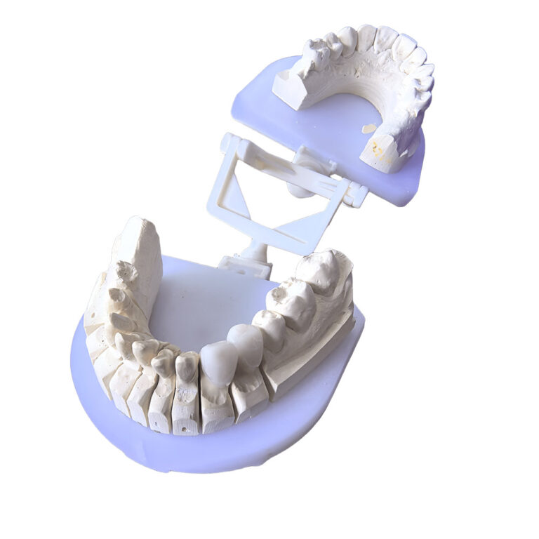 Bl2 Zirconia Crowns