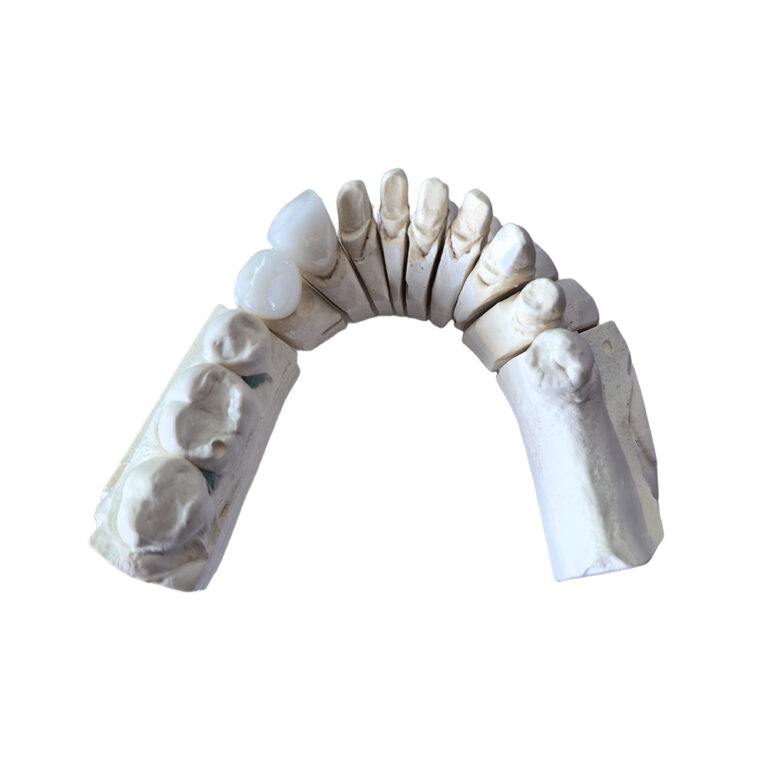 Bl2 Zirconia Crowns