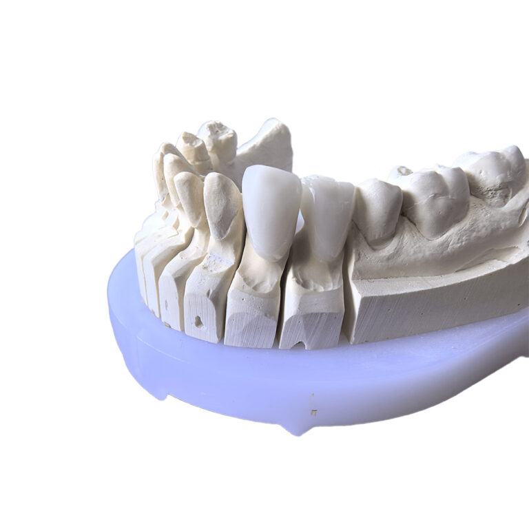 Bl2 Zirconia Crowns