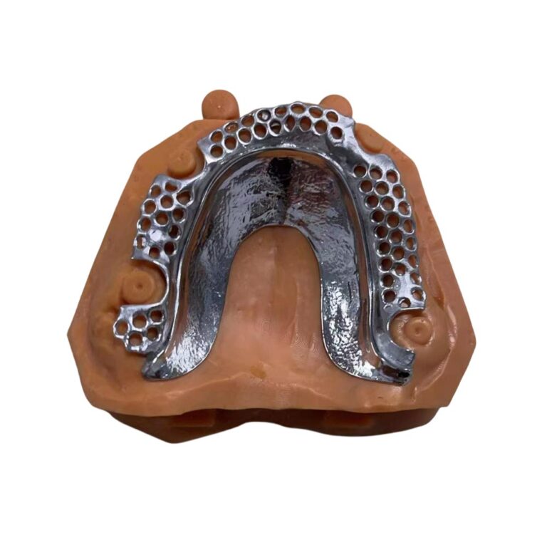Cast Partial Metal Dentures