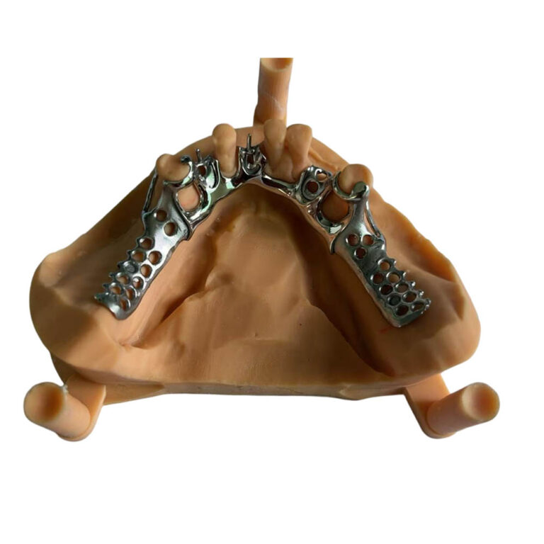 Cast Partial Metal Dentures