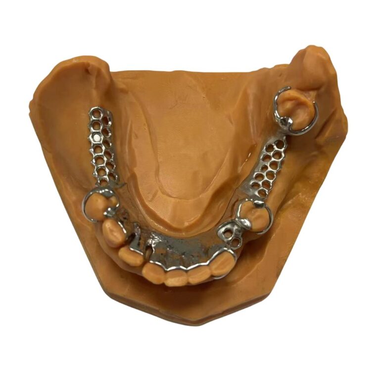 Cast Partial Metal Dentures