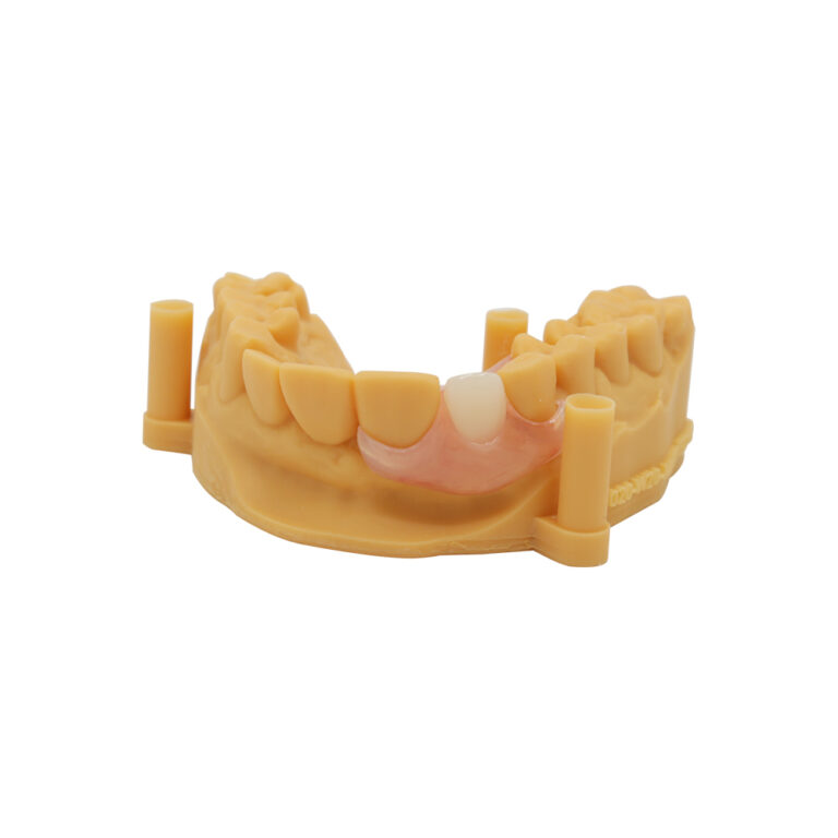 Clasps for Partial Dentures
