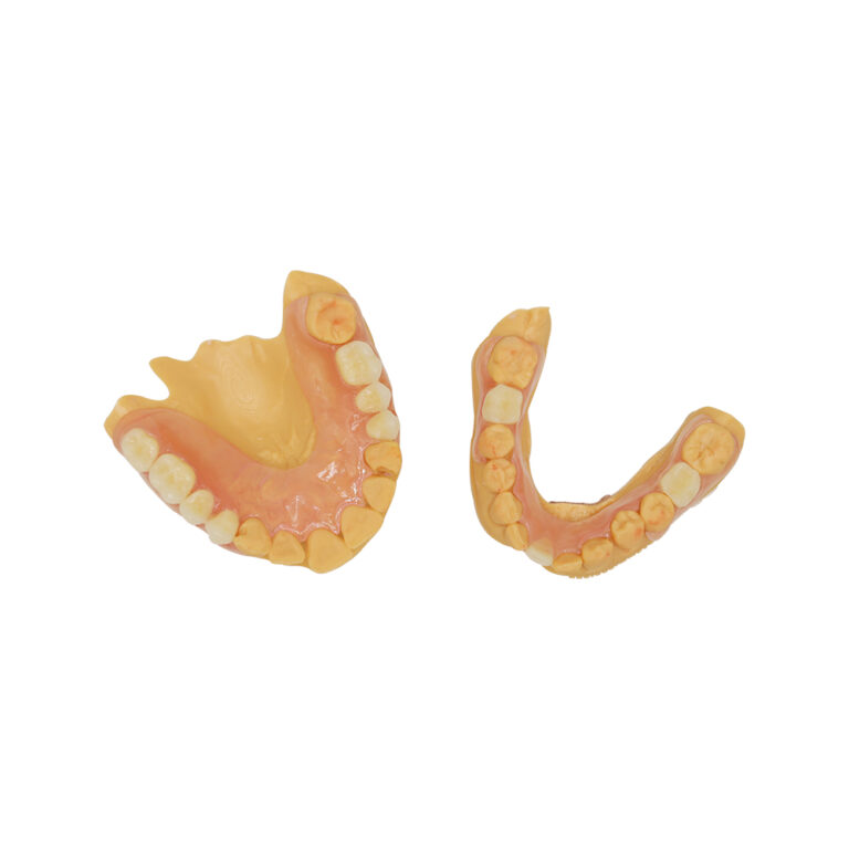 Clasps for Partial Dentures