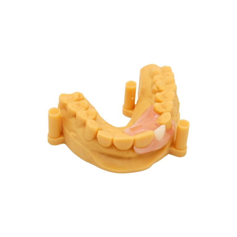 Clasps for Partial Dentures