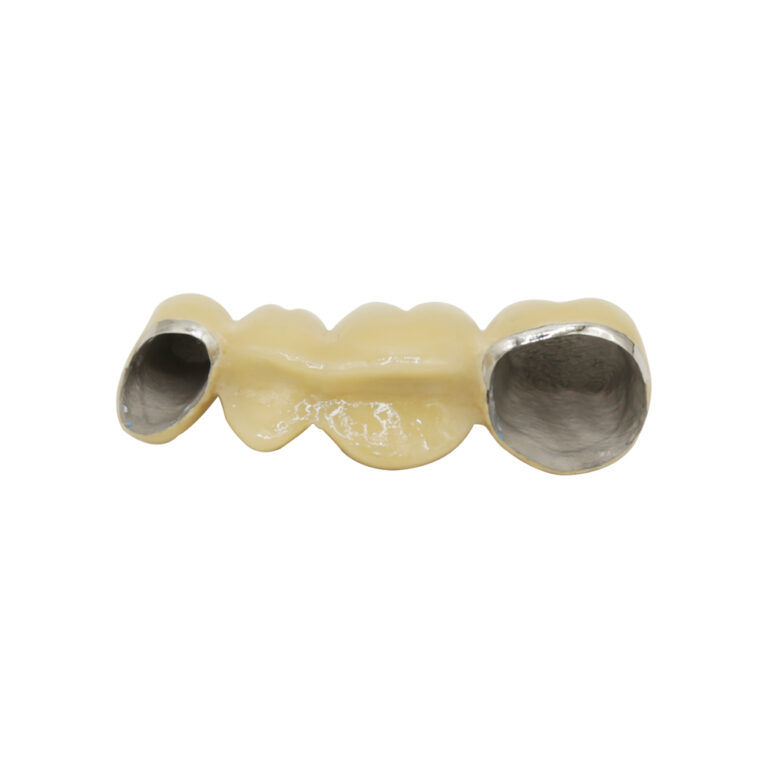 Dental Metal Collar PFM Crown