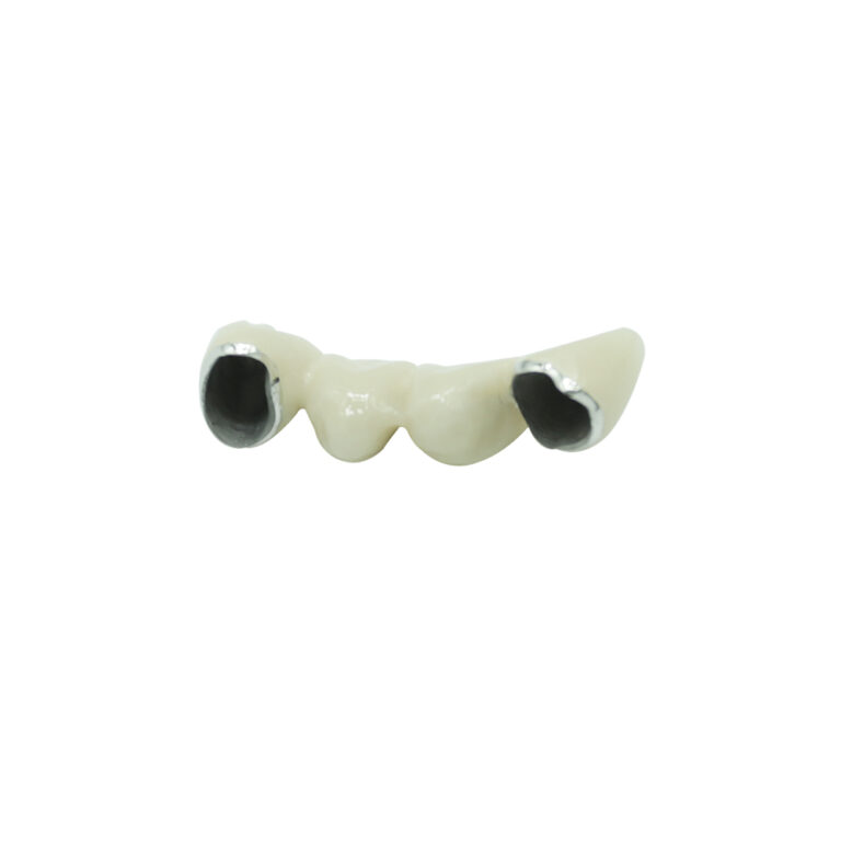 Dental Metal Collar PFM Crown