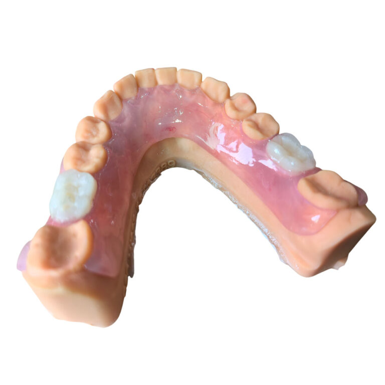Flexible Denture Two Teeth