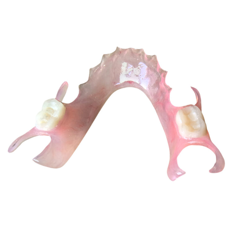 Flexible Denture Two Teeth