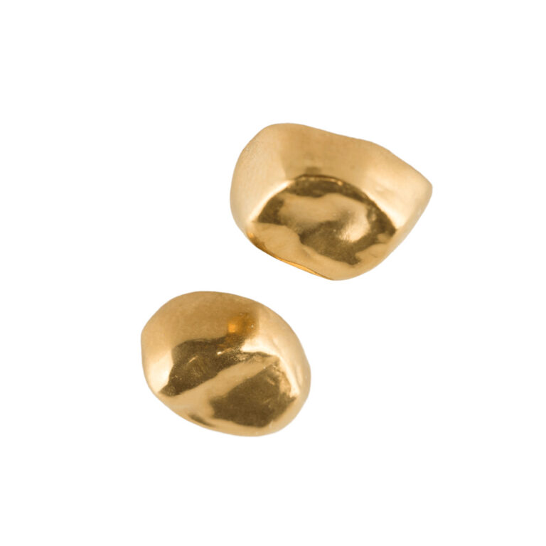 Gold Inlays And Onlays