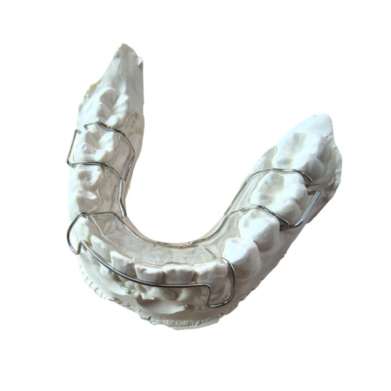 Hawley Orthodontic Retainer
