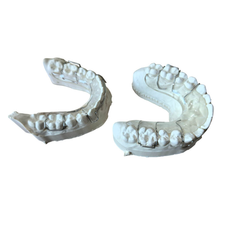 Hawley Orthodontic Retainer