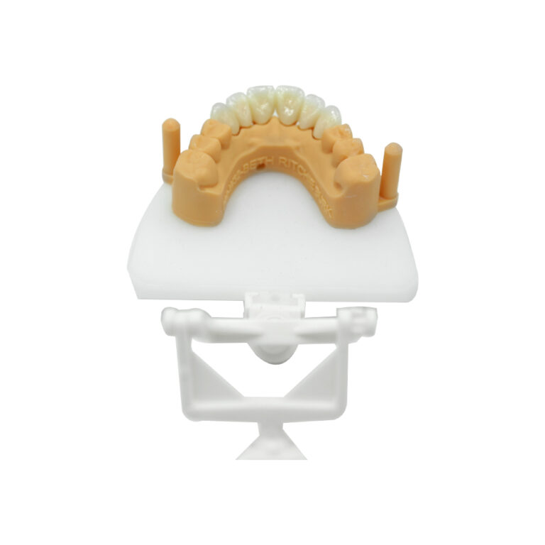 Layered Zirconia Crown