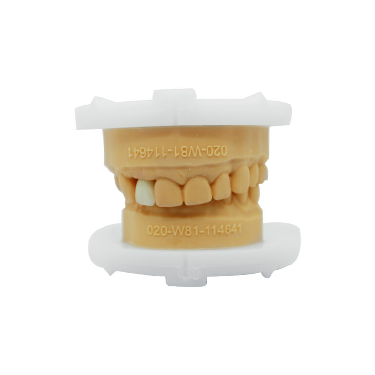 Layered Zirconia Crown
