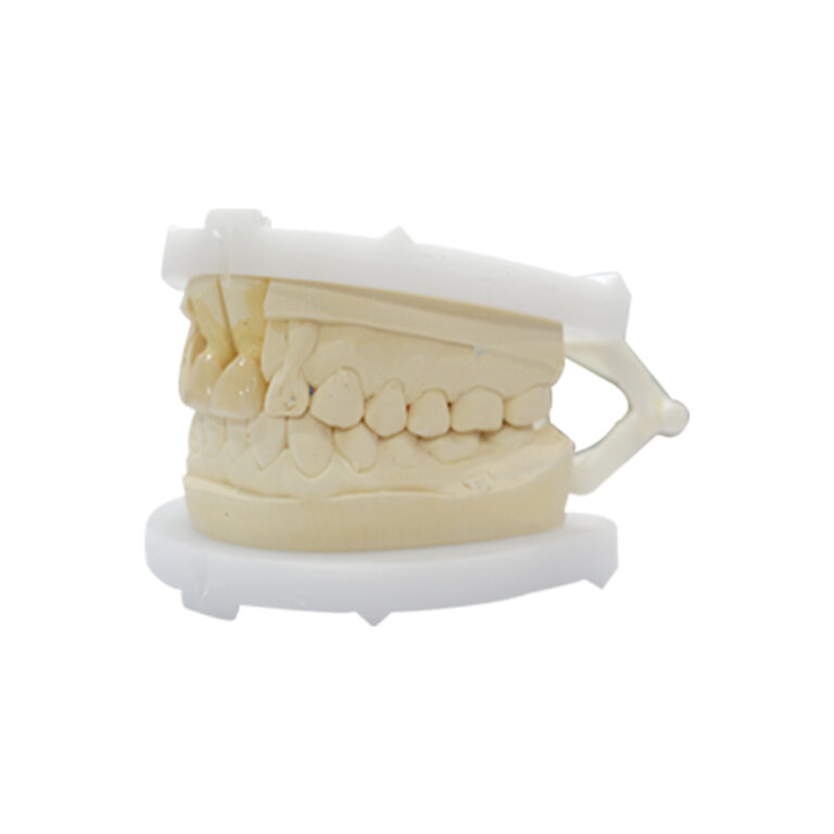 Layered Zirconia Crown