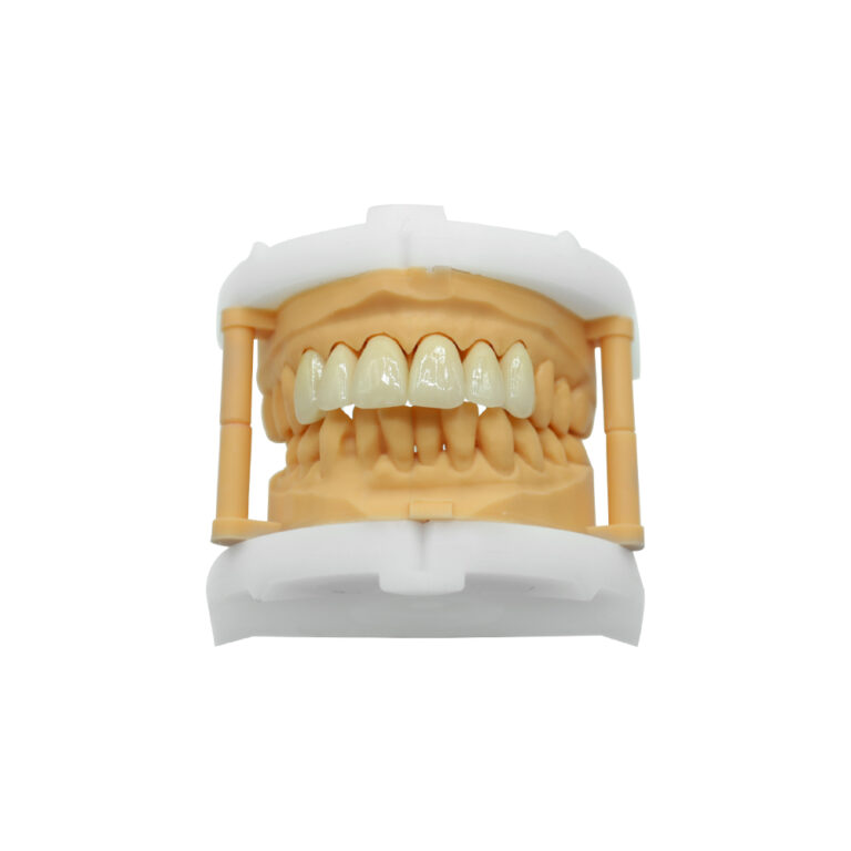 Layered Zirconia Crown