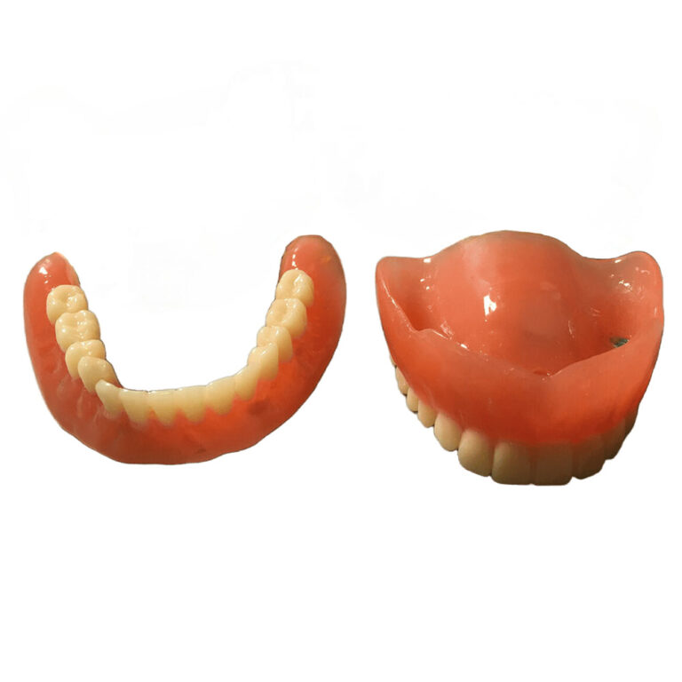 Magnetic Dentures