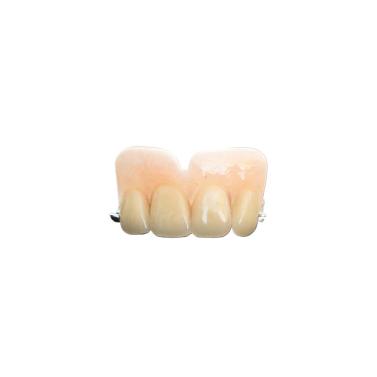 Metal Dentures For Front Teeth