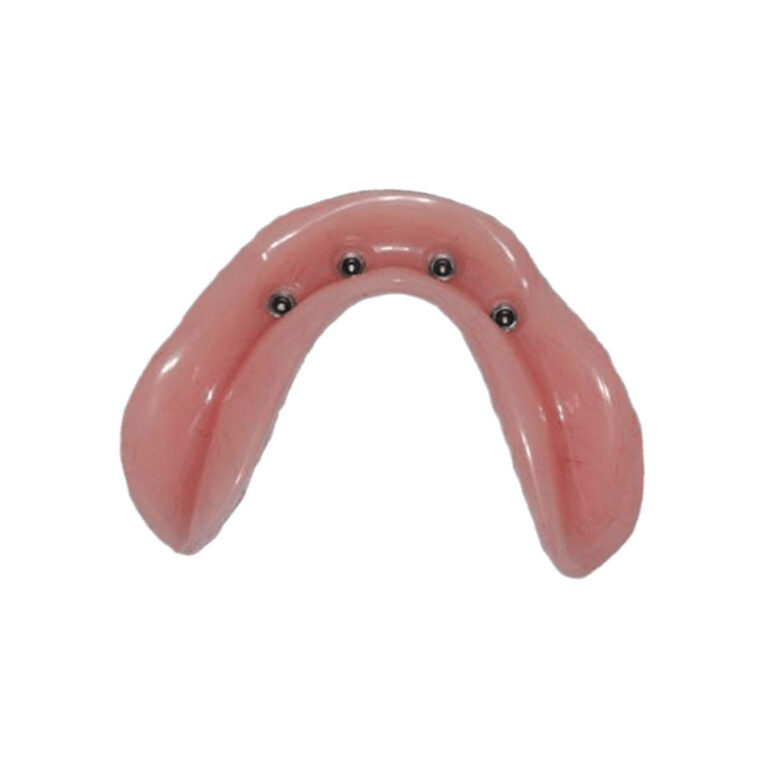 Mini Implants For Dentures