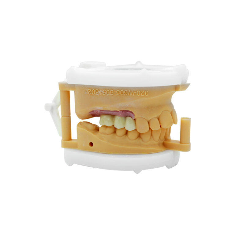 Multiple Dental Implants