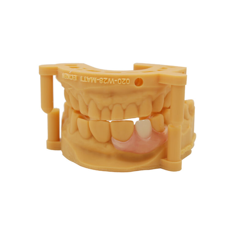 One Tooth Partial Denture