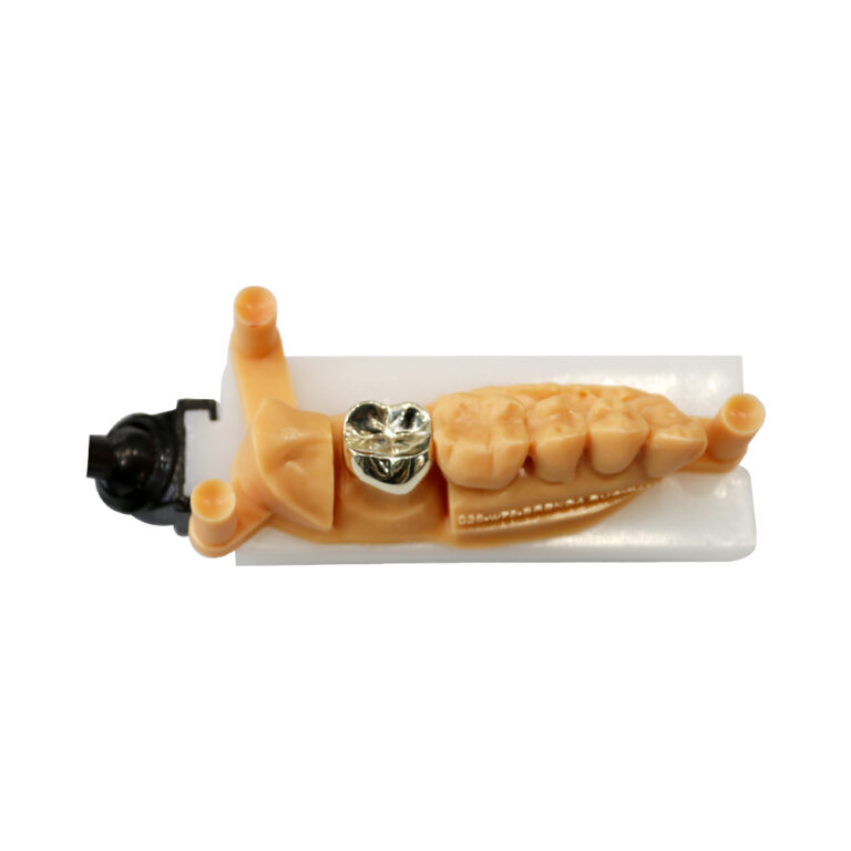 PFM Crown Metal Occlusal