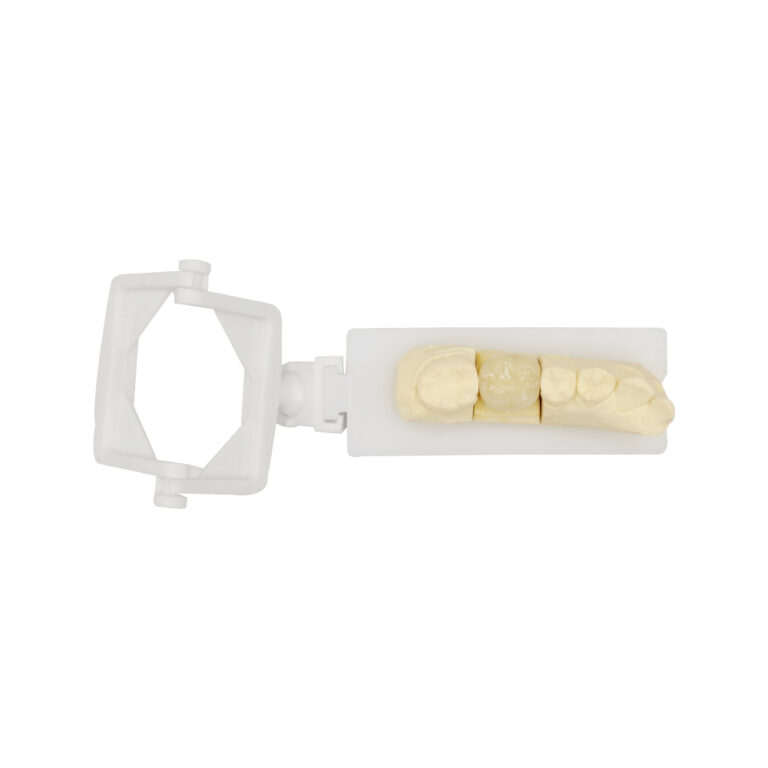 PFM Crown Molar