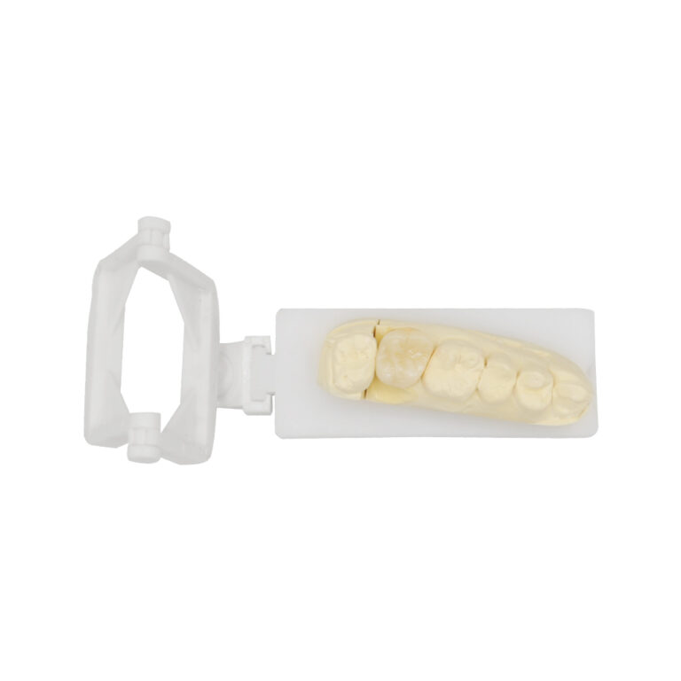 PFM Crown Molar