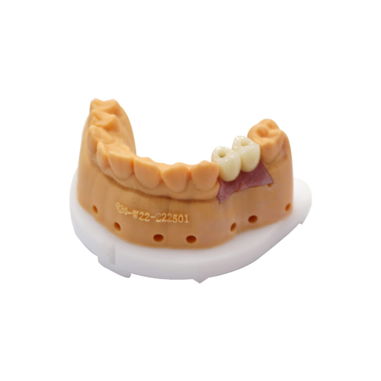 Partial Dental Implants