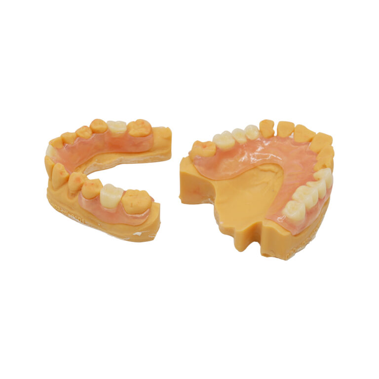 Partial Dentures For Front and Back Teeth