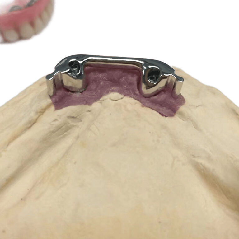 Precision Attachment Partial Denture