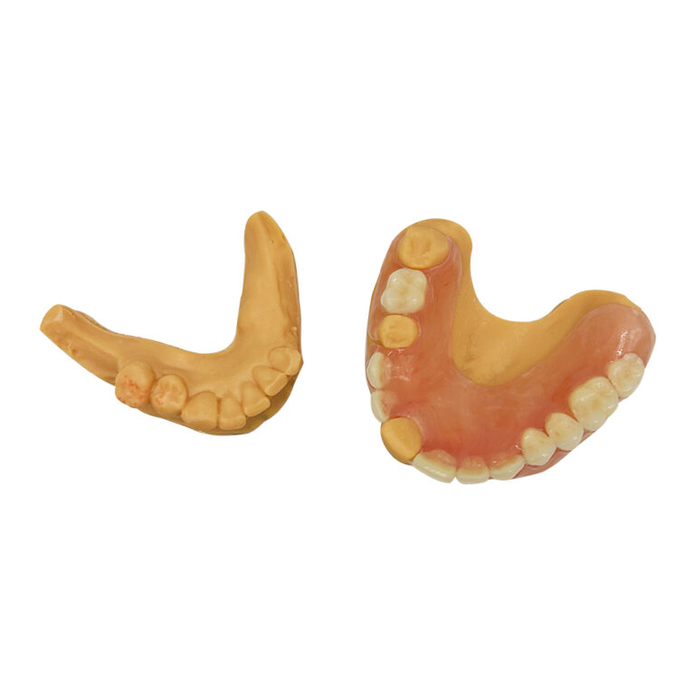 Temporary Immediate Dentures