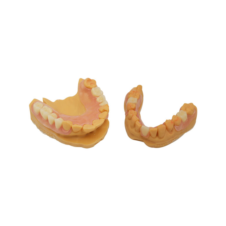 Upper and Lower Partial Dentures