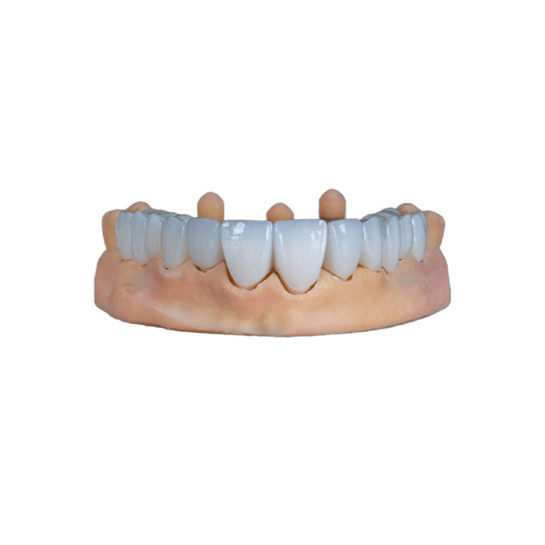 White Zirconia Crowns