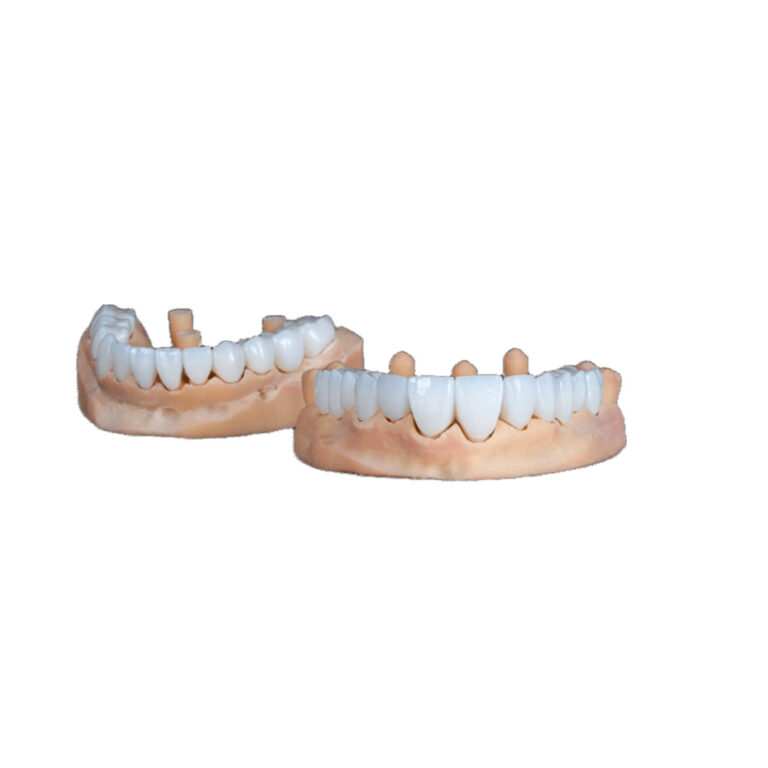 White Zirconia Crowns