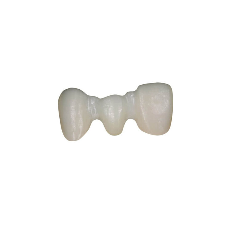 Zirconia Coping Crown