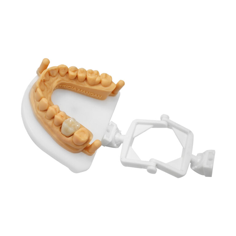Zirconia Crown for Posterior Teeth