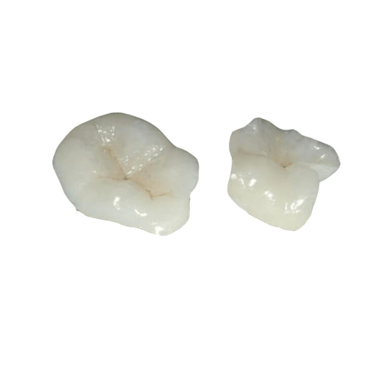 Zirconia Inlay