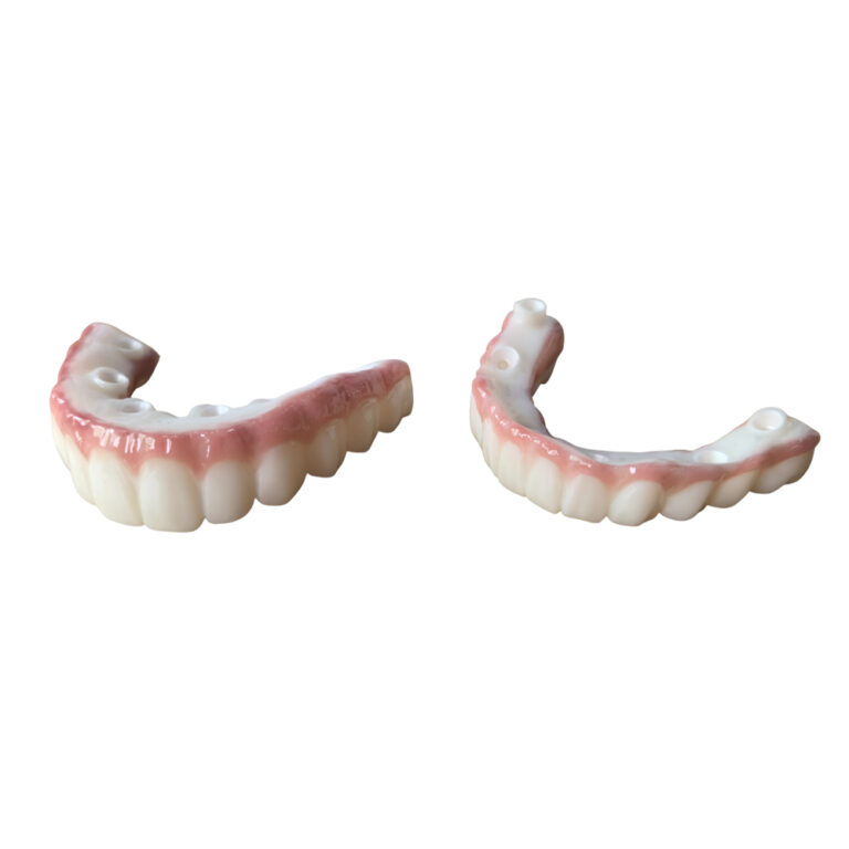 all on 6 zirconia implants