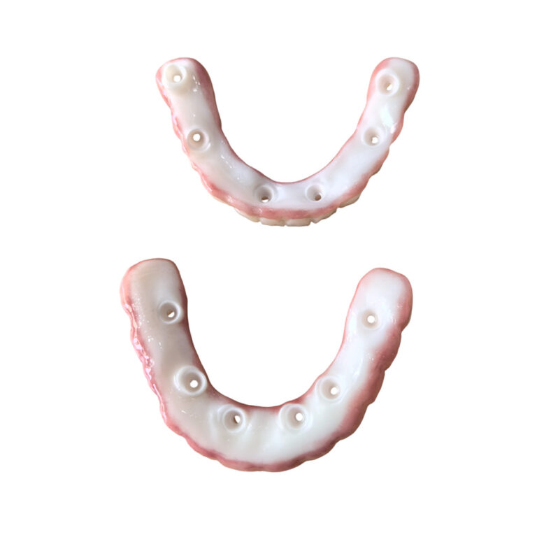 all on 6 zirconia implants