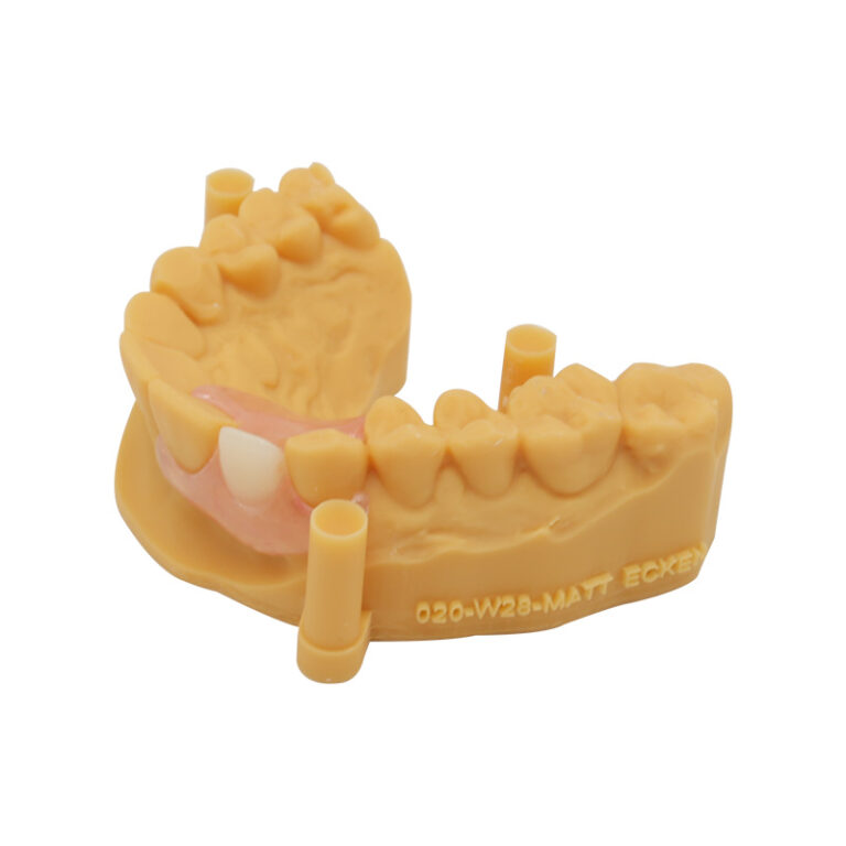 flexi denture single tooth
