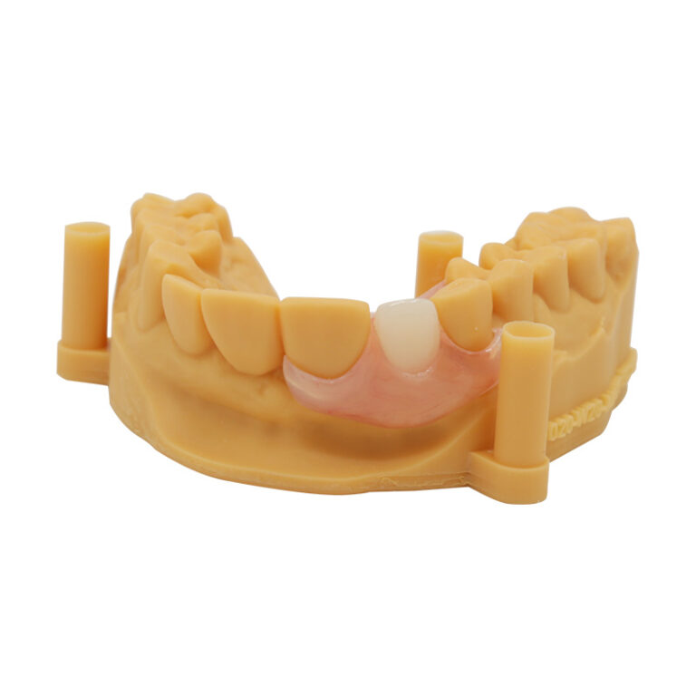 flexi denture single tooth
