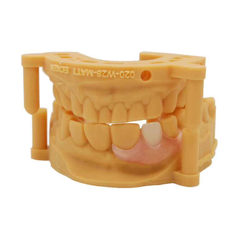 flexi denture single tooth